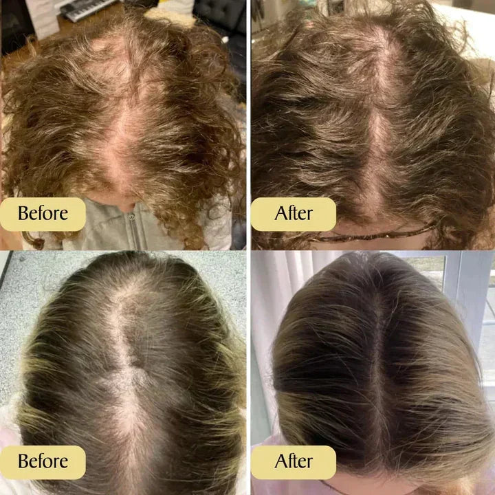 Marvella Natural Hair Growth Oil | Lersk