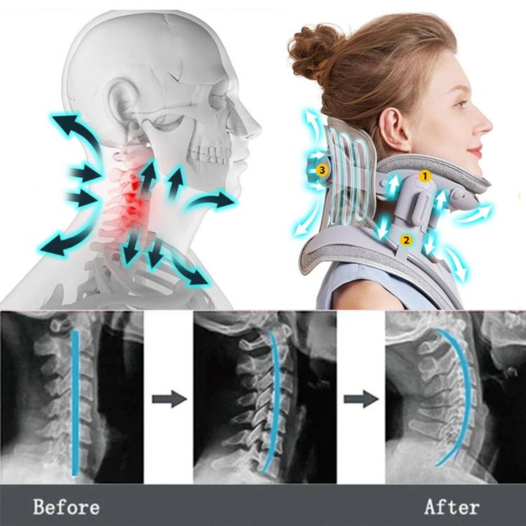 AlignEase Adjustable Neck Traction Device For Pain Relief | Lersk