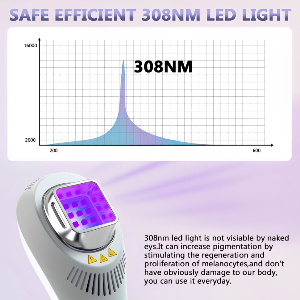 VitaLuma 308nm UVB fototerapeutická lampa na vitiligo pro domácí použití | Lersk