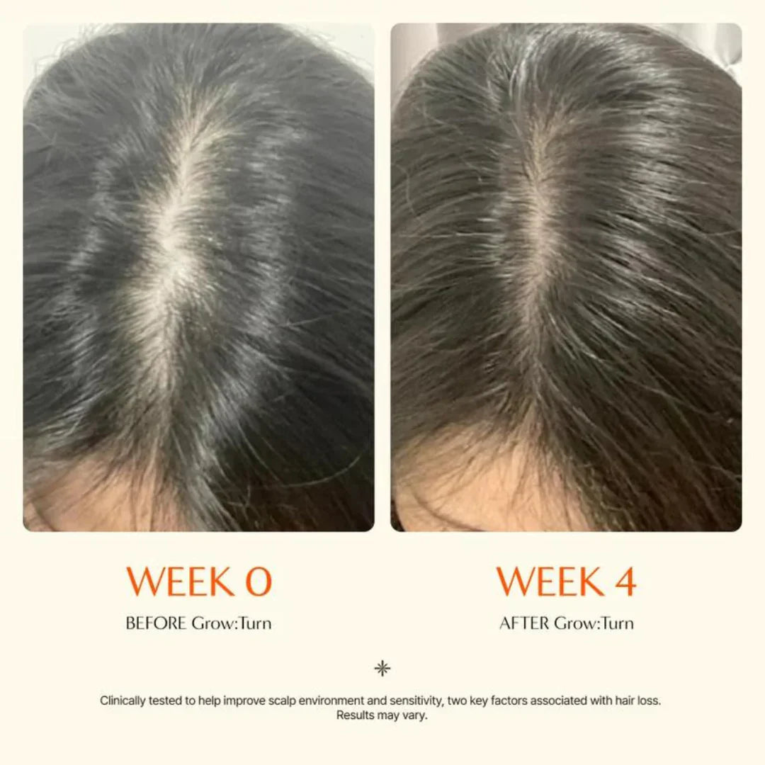 Sérum Avanzado para el Cuero Cabelludo para el Crecimiento del Cabello Reduce la Caída, el Adelgazamiento y la Irritación | Lersk