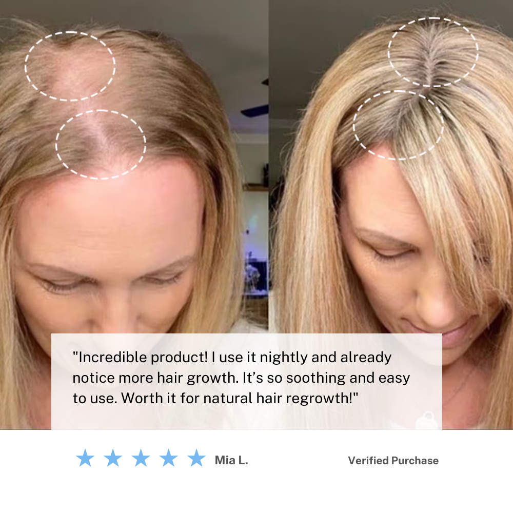 Cordless Scalp Massager Brush | Supports Hair Health & Relaxation at Home | Lersk