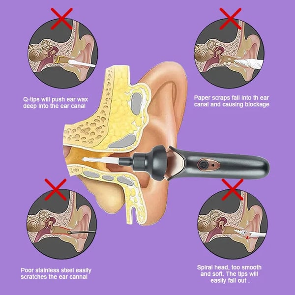 OtoEase Painless Ear Wax Removal Kit for Adults and Kids | Lersk