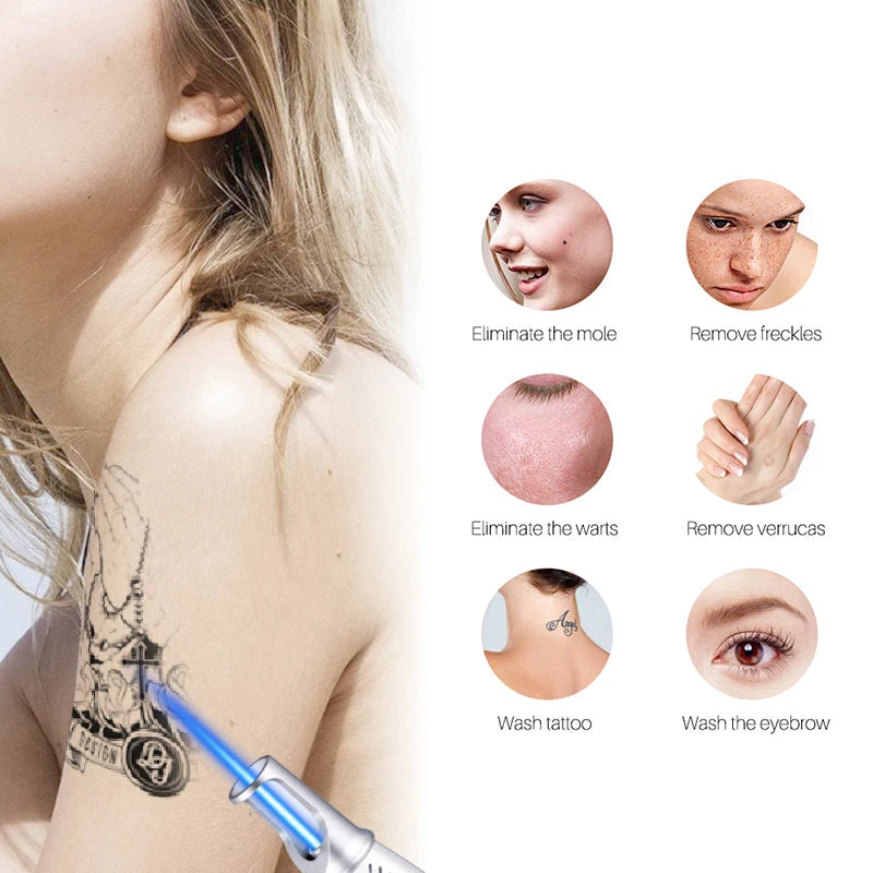 LumiDerm Laser-Stift zur Entfernung von Tätowierungen, Muttermalen und Sommersprossen | Lersk