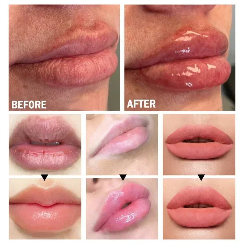 Velara Lip Plumper Serum | Instant Fuller Lips At Home