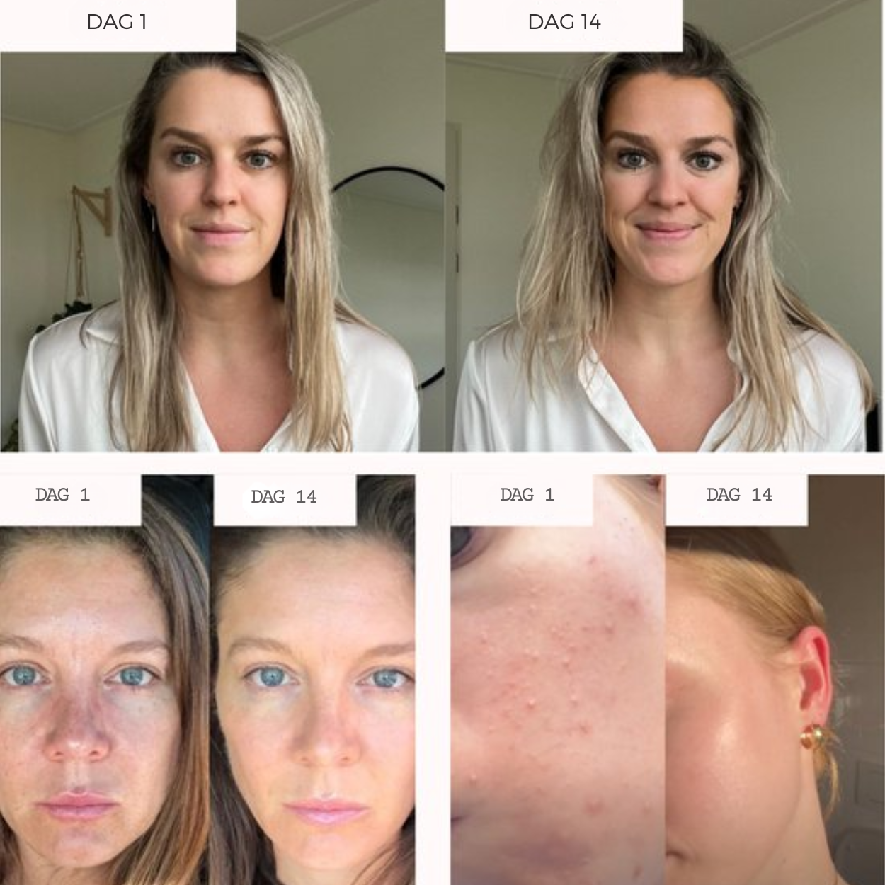 Light Beam Rotes Gesichtsgerät für Frauen Glättet Falten und Reduziert Dunkle Augenringe | Lersk