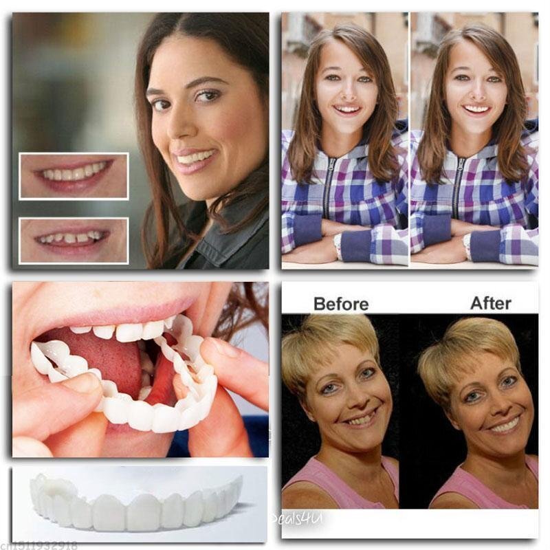 مجموعة أساسيات أطقم الأسنان سناب-أون للاستخدام اليومي وخيارات الاستبدال عبر الإنترنت | ليرسك