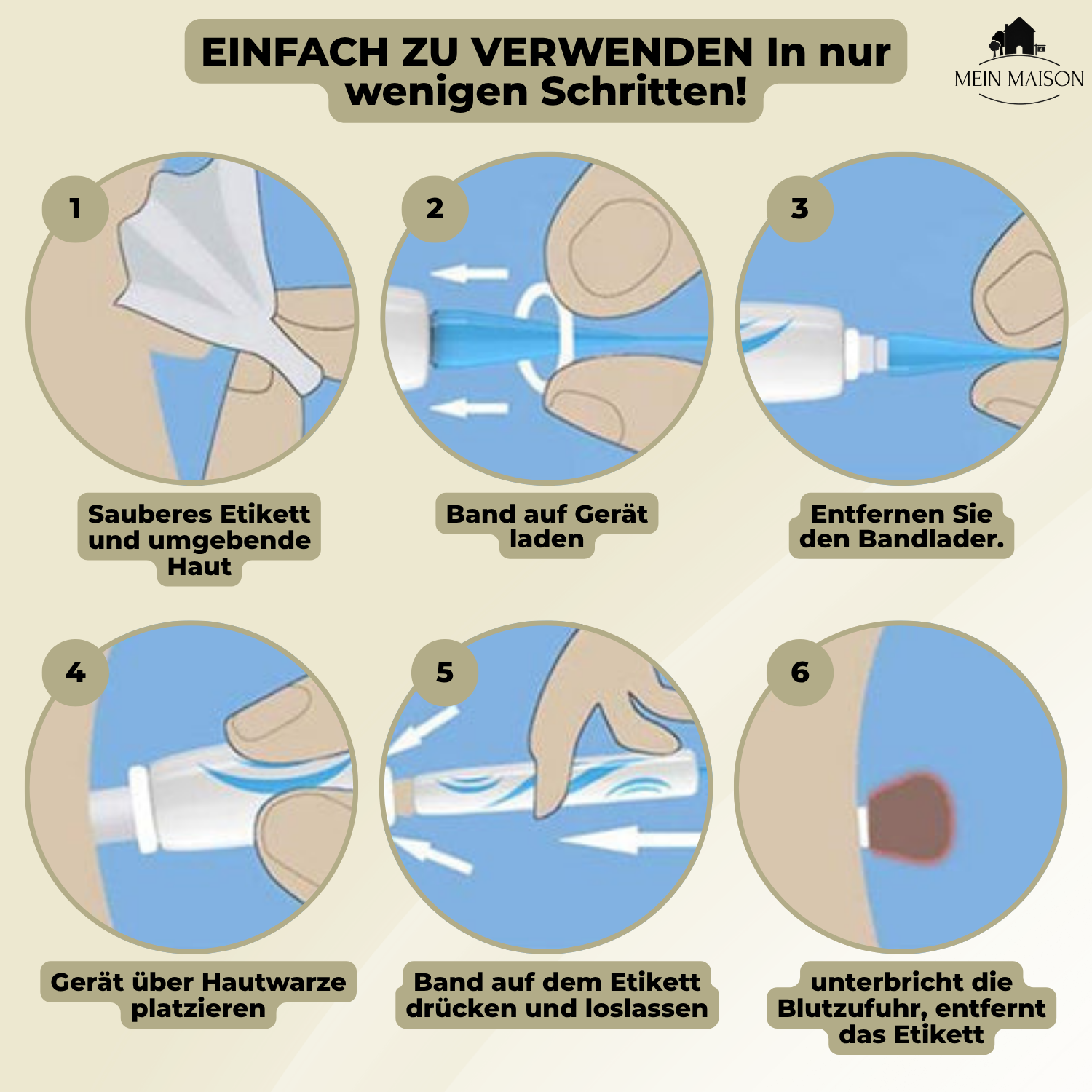 DermaLinx Warzenentferner für den Heimgebrauch Schmerzfreie Entfernung von Warzen und Muttermalen ohne Operation | Lersk