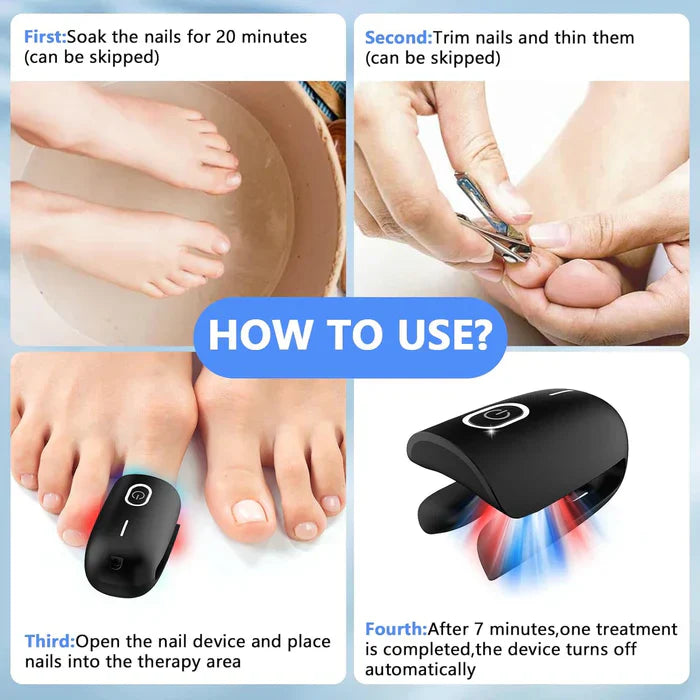 Triple-Wavelength Nail Care Laser Therapy Device for Toenail & Fingernail Wellness | Lersk