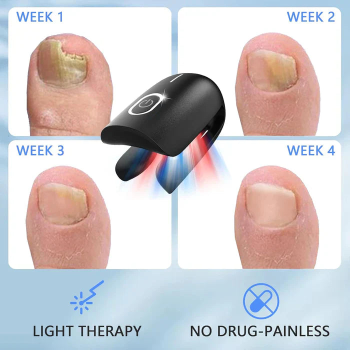 Triple-Wavelength Nail Care Laser Therapy Device for Toenail & Fingernail Wellness | Lersk