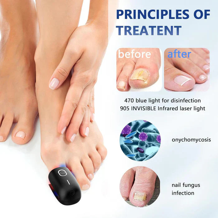 Triple-Wavelength Nail Care Laser Therapy Device for Toenail & Fingernail Wellness | Lersk