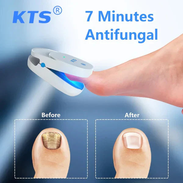 Duales Nagelpflege-Lasergerät mit 905nm- und 470nm-Licht für Nagelgesundheit | Lersk