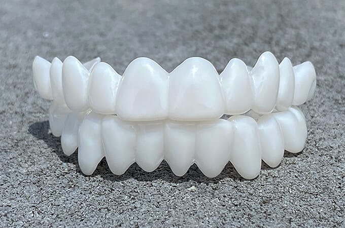 Smile Lens verstellbare weiße Zahnprothese zur direkten Korrektur des Lächelns von Smile Lens Smile Lens | Lersk