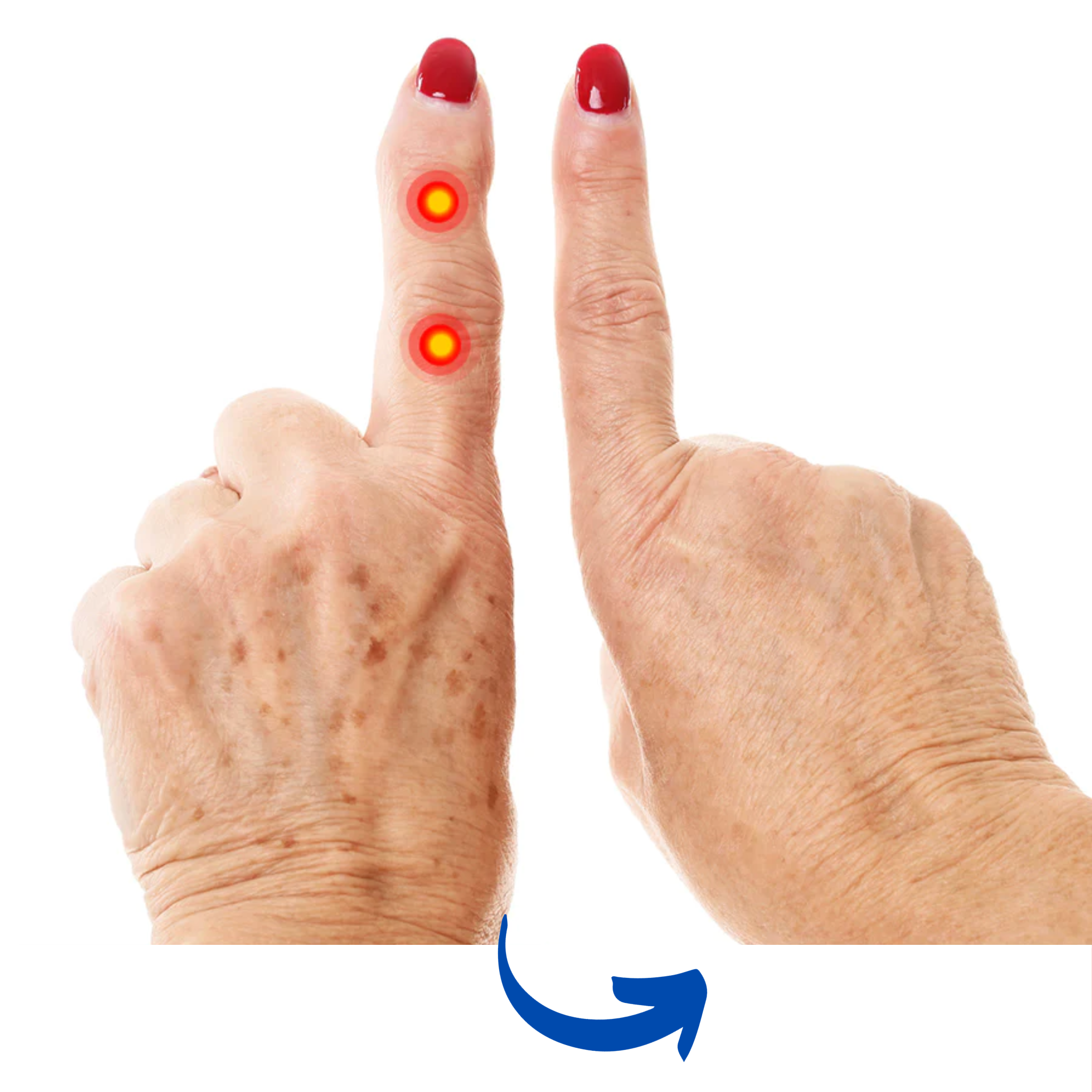 Guanto per Artrite con Terapia a Luce Rossa per Sollievo dal Dolore alla Mano | Lersk