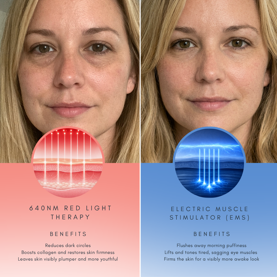 Avansert Dual-Tech Øyeoppfrisker — Rødt Lys & EMS Mikrostromsystem | Lersk