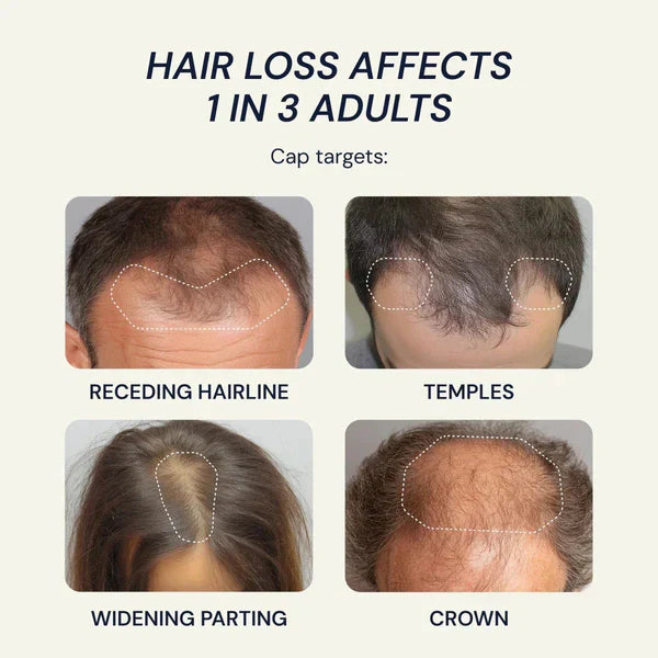 Biochance Red Light Hair Growth Therapy Cap | Lersk
