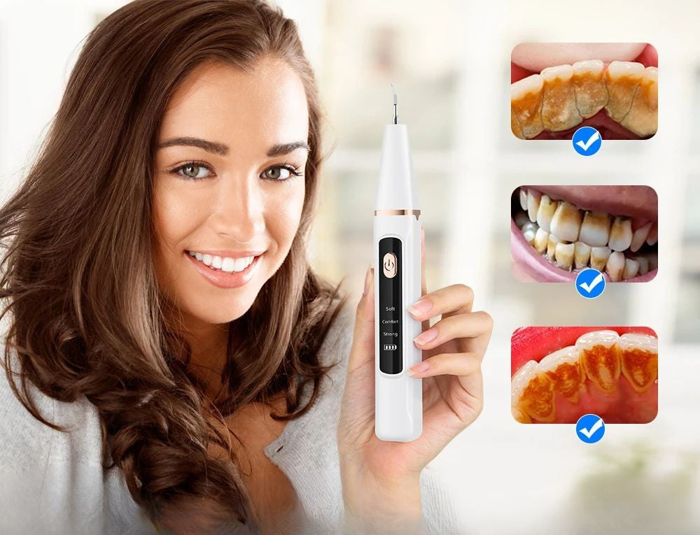 SonicDent 38 kHz Ultrasonic Teeth Cleaner With LED & USB | Lersk