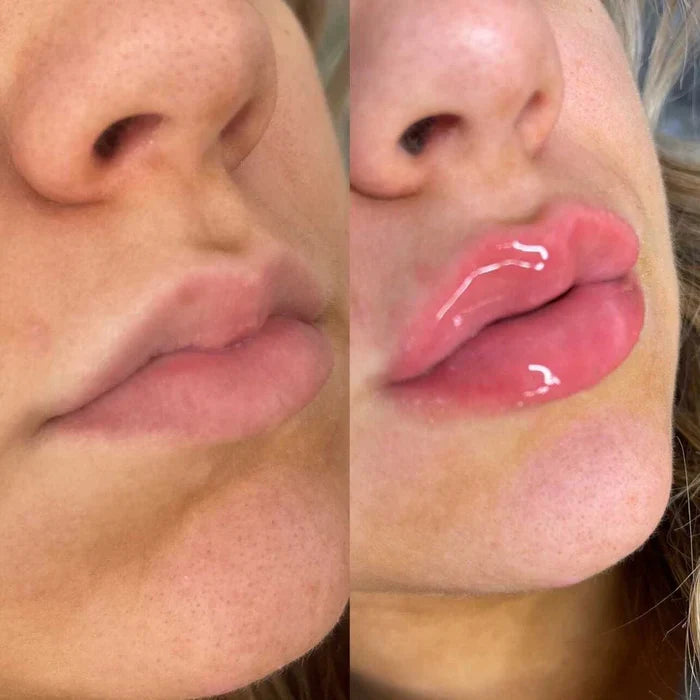 LumaGlow Instant Lip Plumper Serum for Fuller Lips Now | Lersk