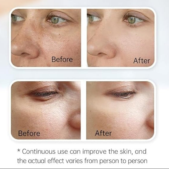 Hydra Pen H3 Microneedling med seruminfusion til hjemmebrug for hudplejeentusiaster | Lersk