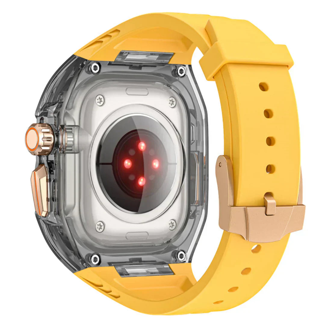 RidgeRun | Apple Watch için Retrofit Kılıf Kiti | Lersk