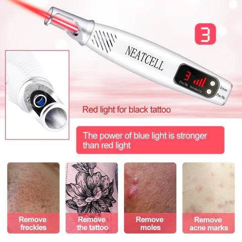 LumiDerm Laser-Stift zur Entfernung von Tätowierungen, Muttermalen und Sommersprossen | Lersk