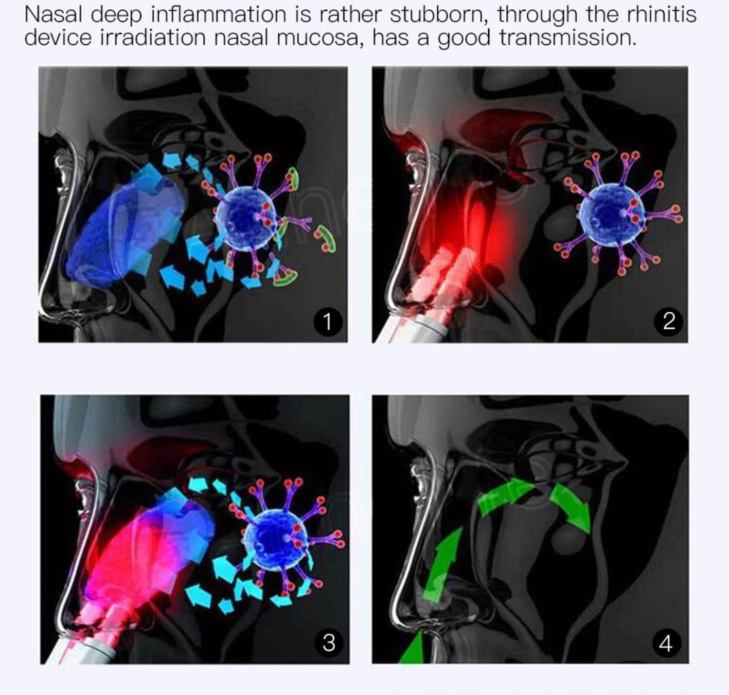 Auraline | Infrared Rhinitis Relief Device For Nasal Care | Lersk