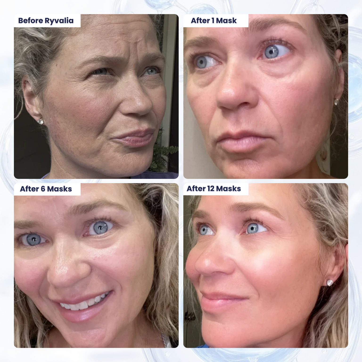 Bio-Collagen Hydrating Face Mask for Deep Moisture, Elasticity & Radiance | Lersk