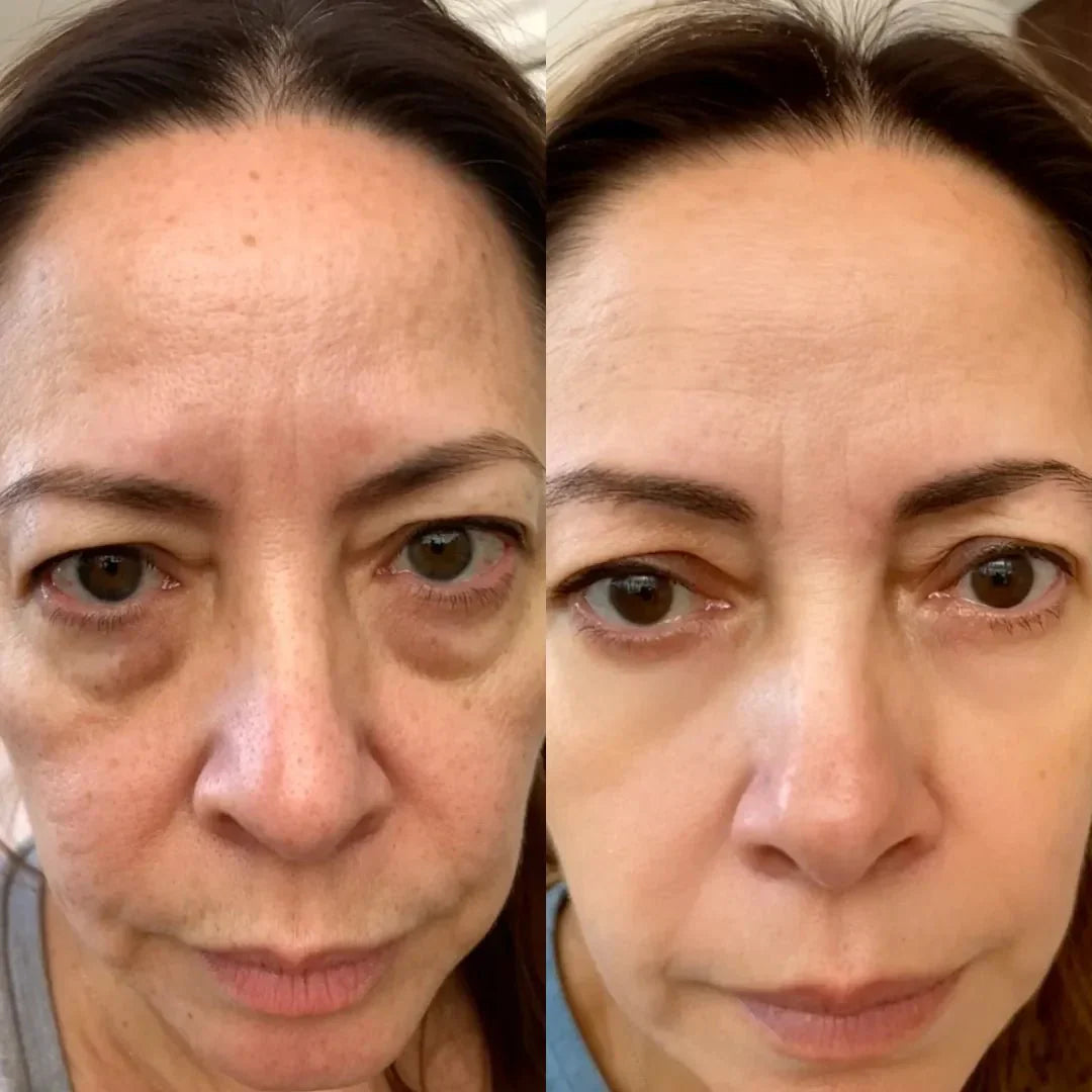 LumaNova Eye Rejuvenator Red Light and Microcurrent Therapy | Lersk