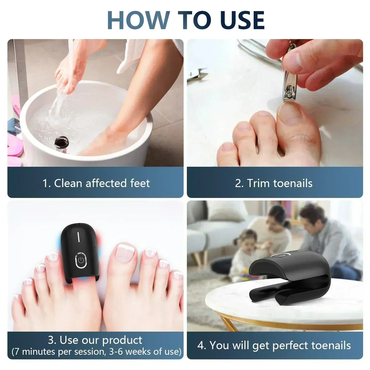 AstraNail Toenail Laser Therapy Portable USB Charging Fungal Nail Treatment