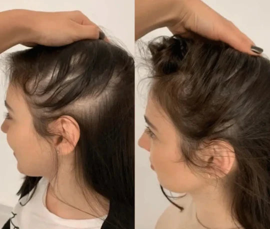 Lumora The Natural Escova Restauradora de Cabelo 3 em 1 | Massajador de Couro Cabeludo | Lersk