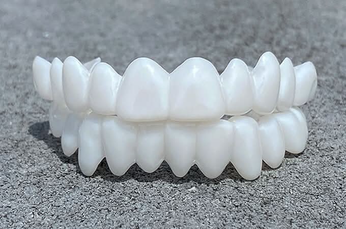 SmileFlex Dental Prosthesis With White Veneers For A Subtle, Lifelike Smile And Natural Look | Lersk