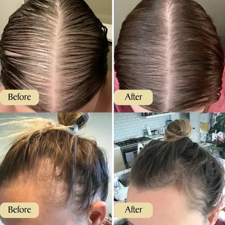 Marvella Natural Hair Growth Oil | Lersk