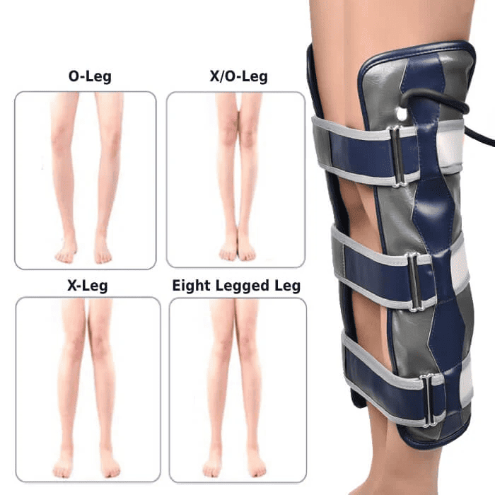 Lunara Bow Legs Realignment Belt With Secure Straps | Lersk