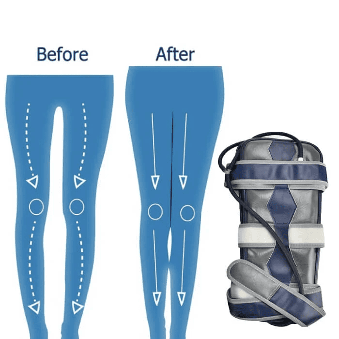 Lunara Bow Legs Realignment Belt With Secure Straps | Lersk