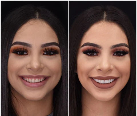LumaGrin Facette Instantanee Adesive per Denti Superiori e Inferiori | Lersk