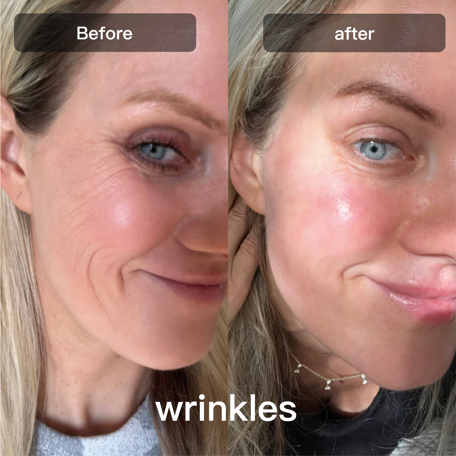 LED Light Therapy Device | 7-Wavelength LED Light Therapy Device for Face & Body | Lersk