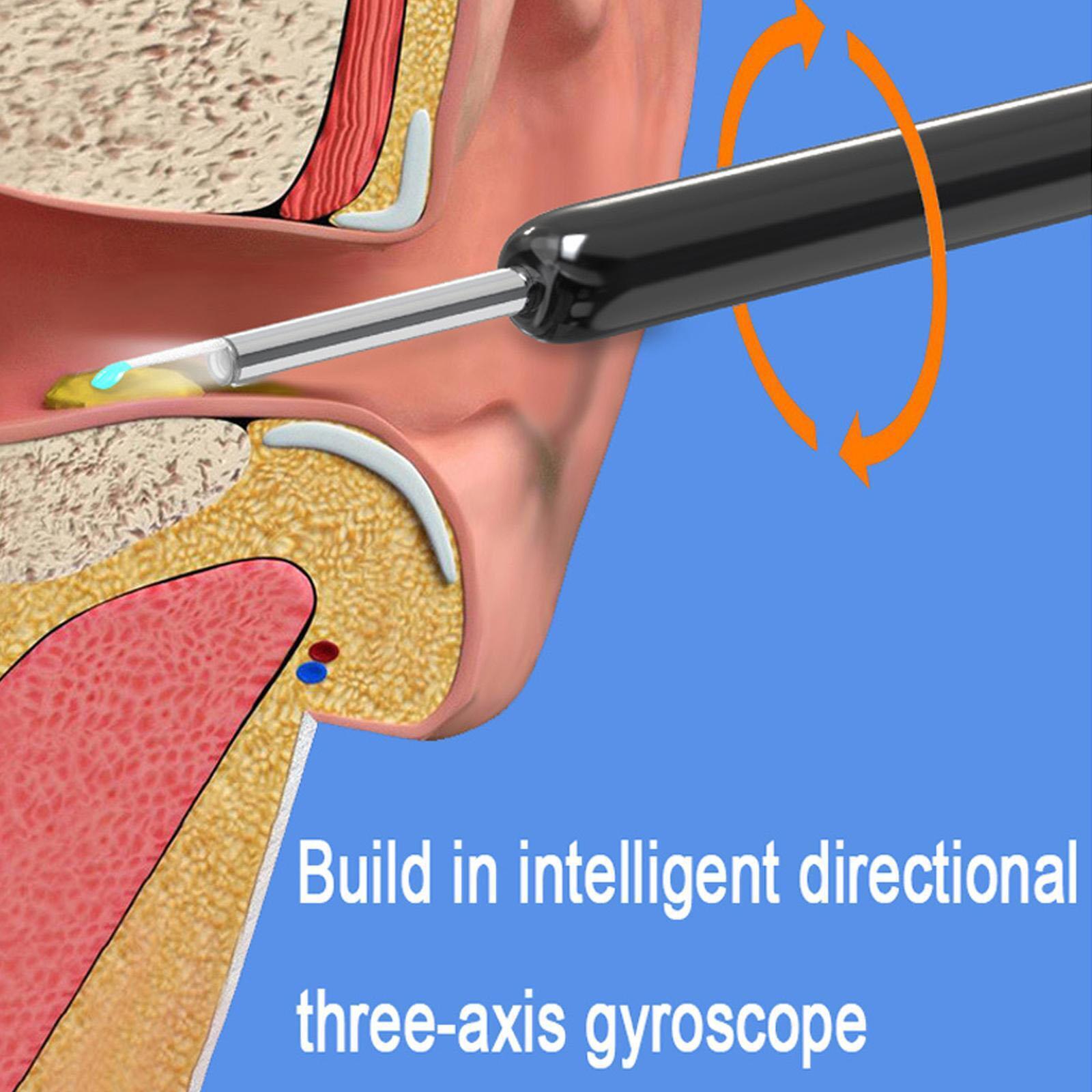 Auravue Earwax Inspection Camera | Lersk