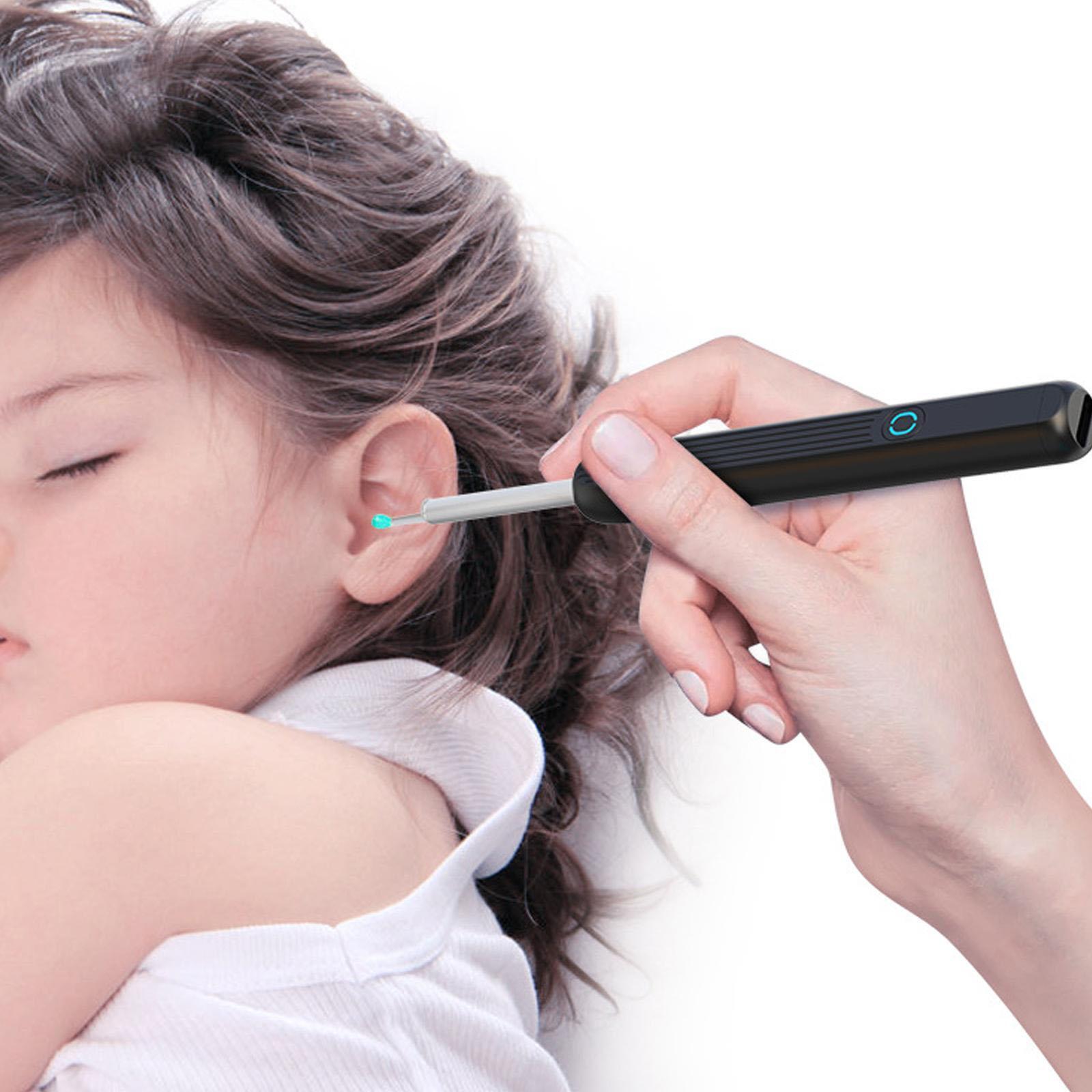 Auravue Earwax Inspection Camera | Lersk