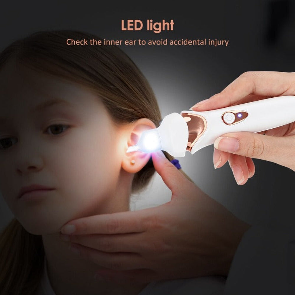 QuietEar Gentle Ear Wax Vacuum for Safe Removal at Home | Lersk