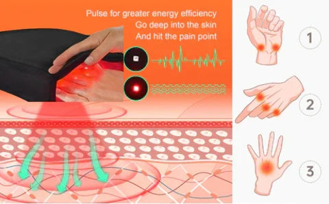 ArthroGlow Near Infrared Hand Therapy Gloves for Arthritis