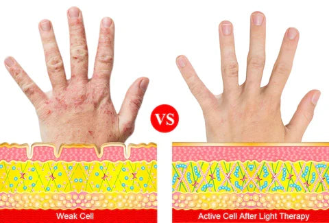 ArthroGlow Near Infrared Hand Therapy Gloves for Arthritis