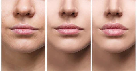 Velara Lip Plumper Serum | Instant Fuller Lips At Home