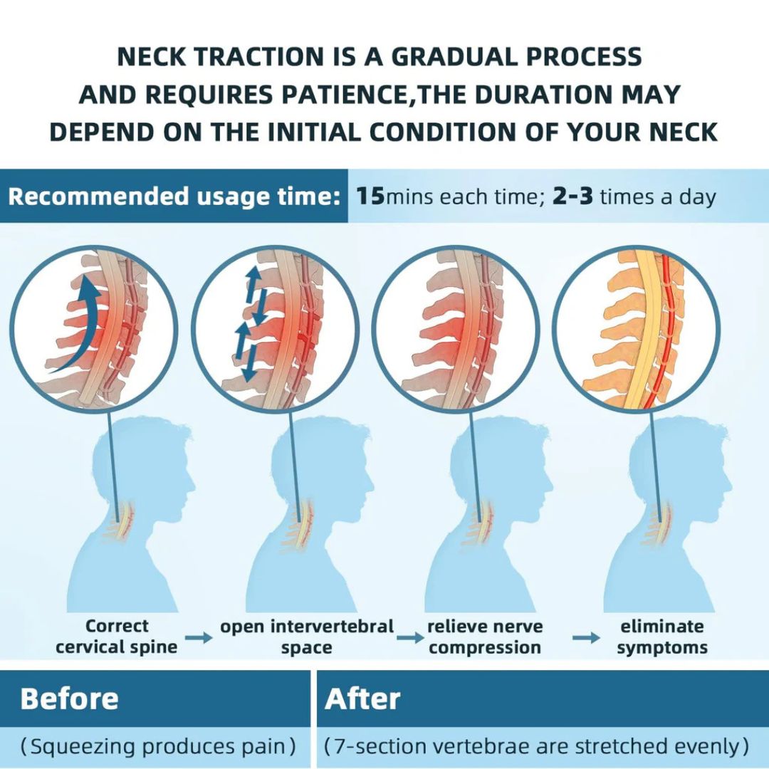AlignEase Adjustable Neck Traction Device For Pain Relief | Lersk