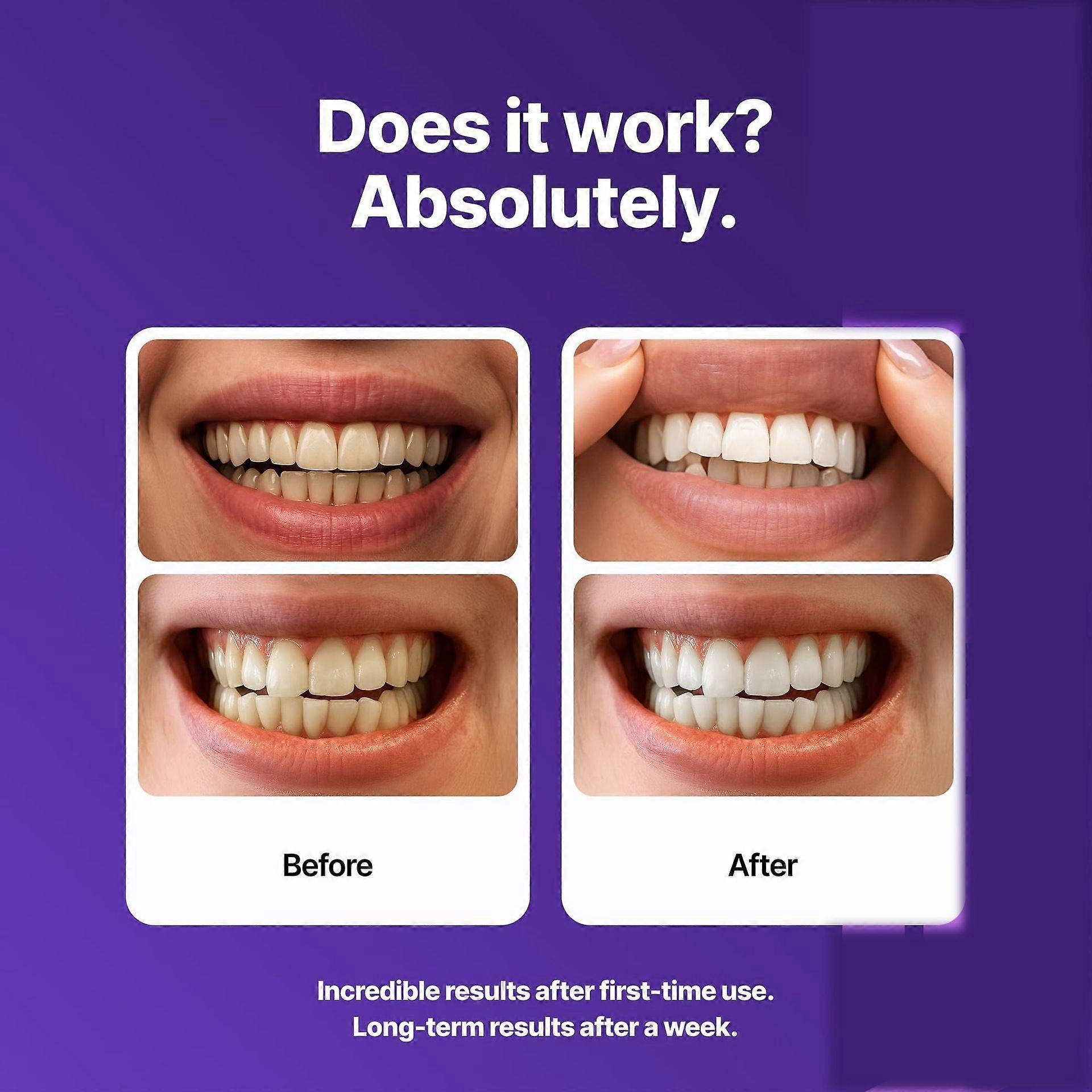 V34 Purple Whitening Strips – Instant Color-Correcting Teeth Whitening with PAP+ Technology | Lersk