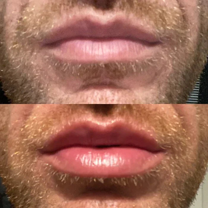Velara Lip Plumper Serum | Instant Fuller Lips At Home | Lersk