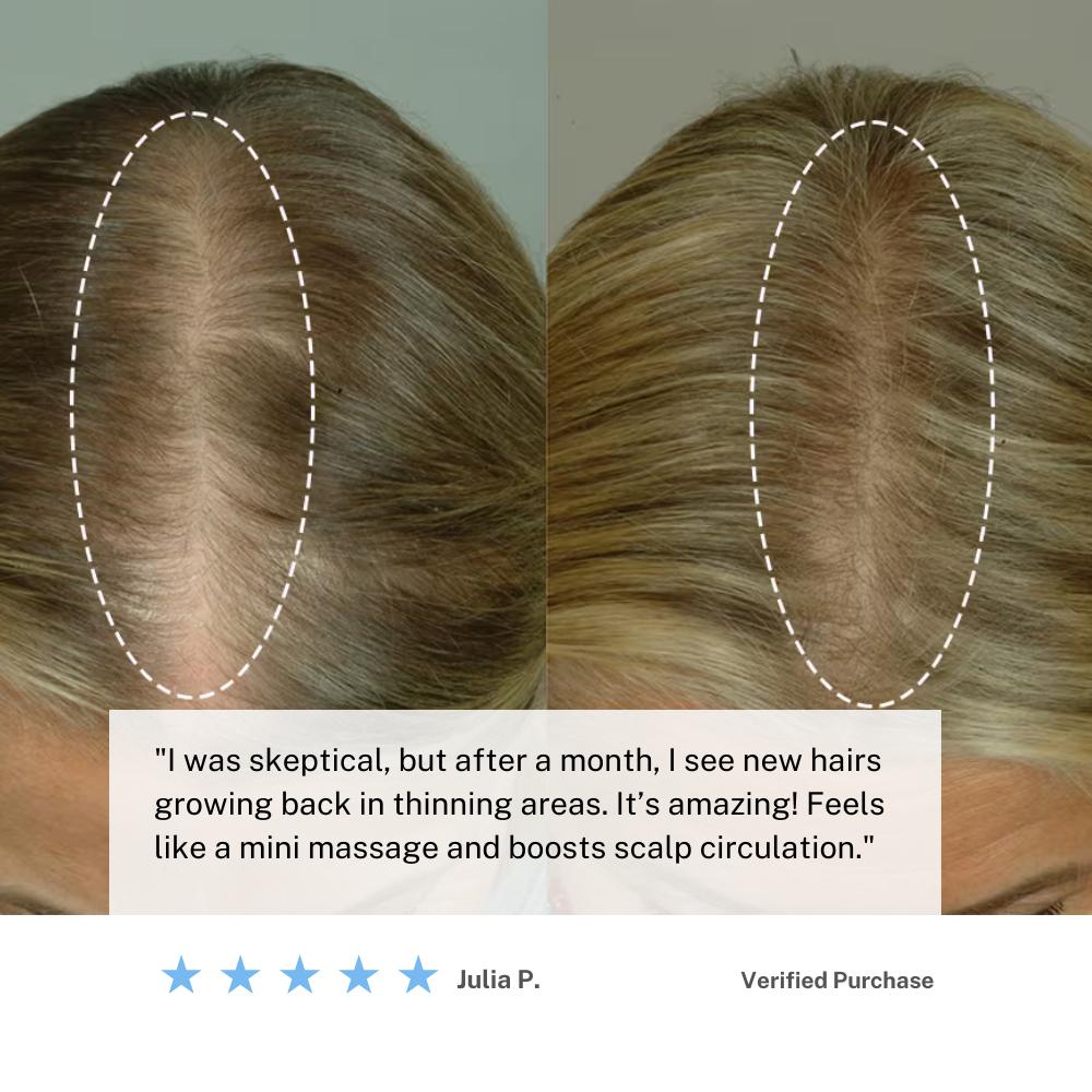 Cordless Scalp Massager Brush | Supports Hair Health & Relaxation at Home | Lersk