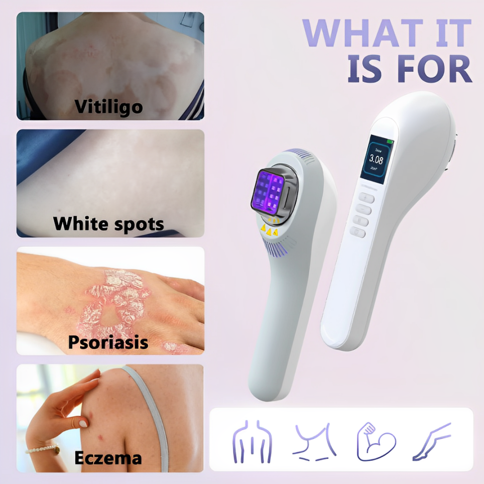 308nm UVB Vitiligo Lamp For Home Use Psoriasis Therapy | Lersk