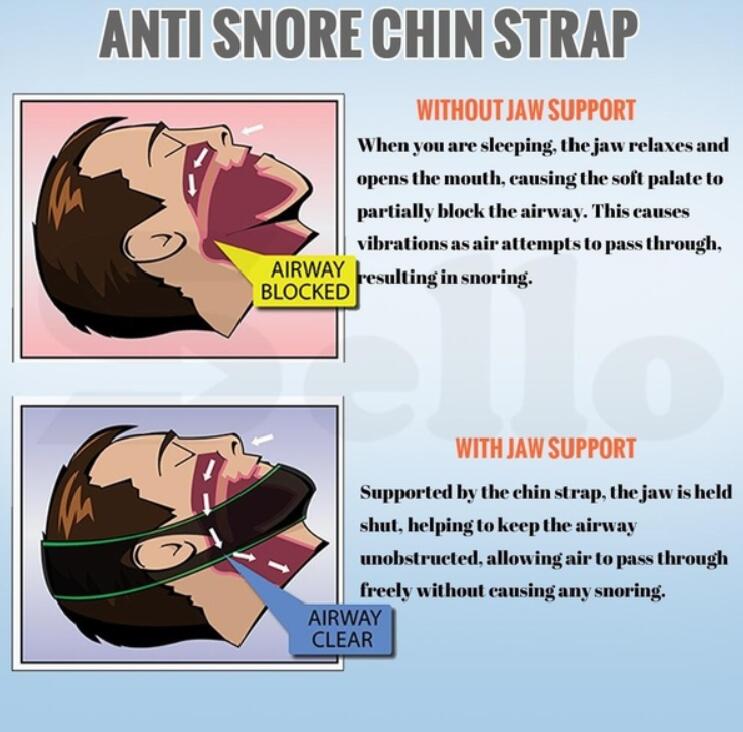 SomniBand Neoprene Chin Strap Belt For Snoring And Sleep Apnea, Black | Lersk