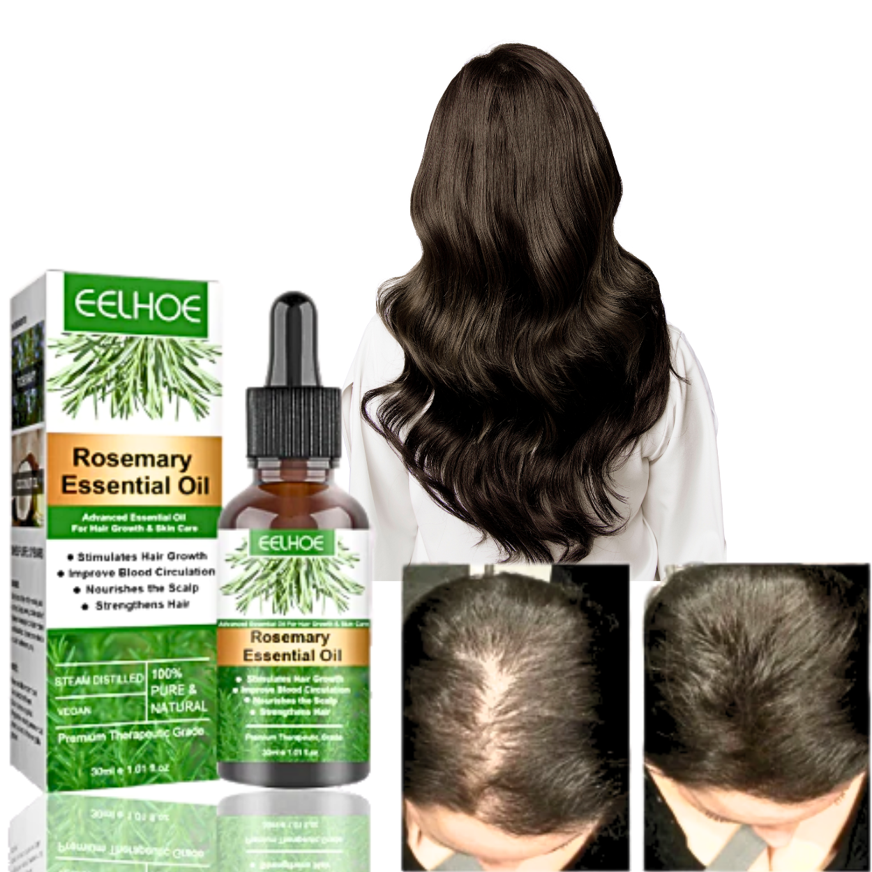 Olio di Rosmarino per la Crescita dei Capelli Rinfresca il Cuoio Capelluto e Allevia il Prurito e la Secchezza | Lersk