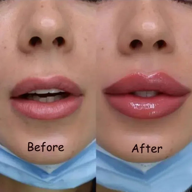 Velara Lip Plumper Serum | Instant Fuller Lips At Home | Lersk