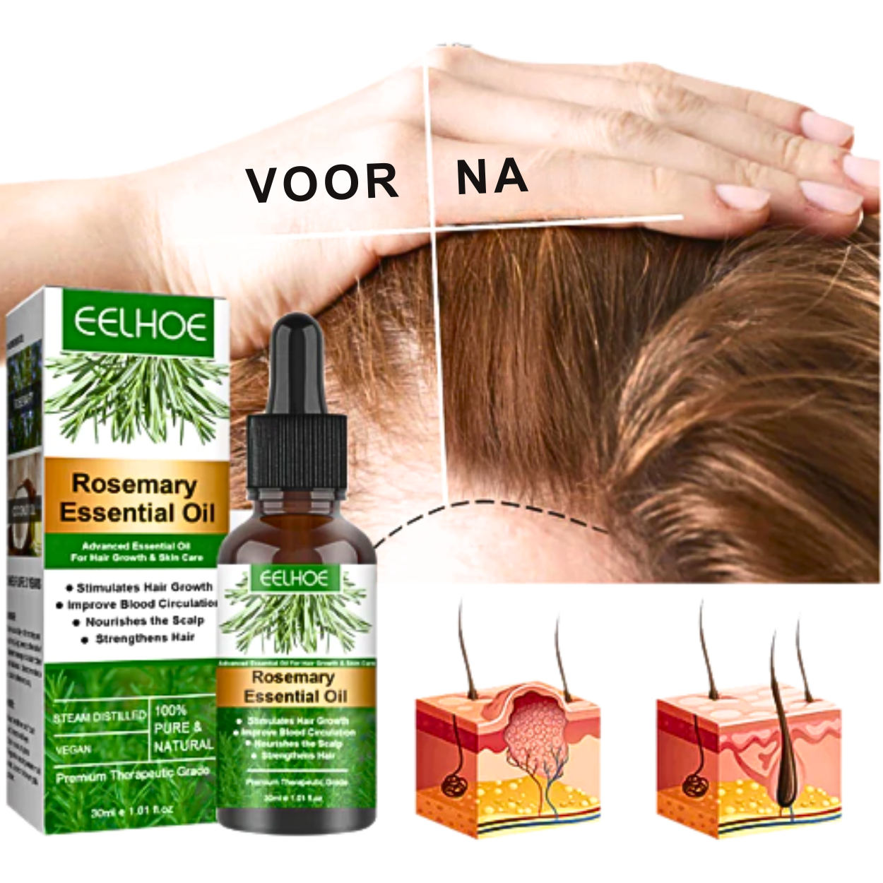 Olio di Rosmarino per la Crescita dei Capelli Rinfresca il Cuoio Capelluto e Allevia il Prurito e la Secchezza | Lersk